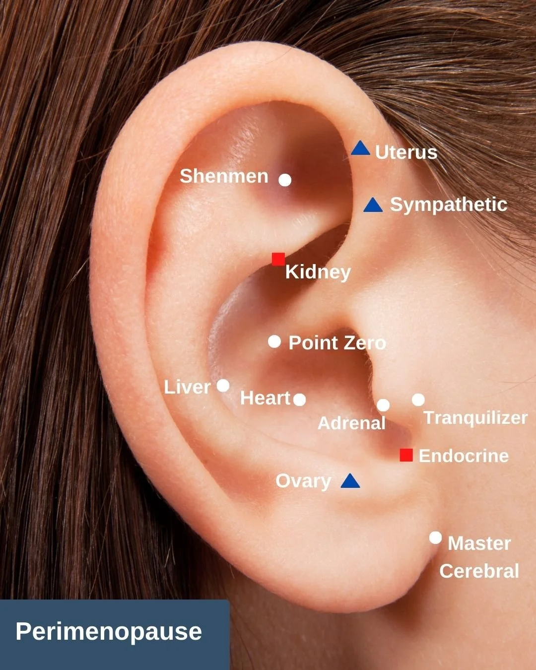 Pressure point 2025 earring for migraine